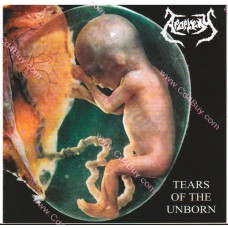 APOPLEXY - Tears Of The Unborn APOPLEXY - Tears Of The Unborn